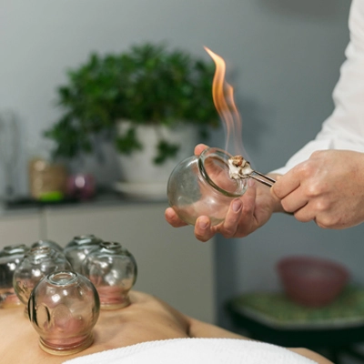 Cupping Therapy